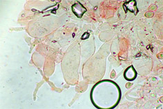 foto de Queilocistidios de Leucocoprinus cepaestipes